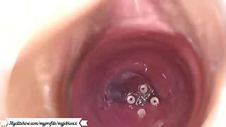 anal
