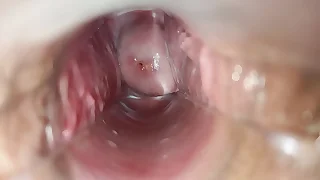 masturbation