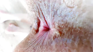 When You Work as a Gynecologist and Your Client Cums From Excitement!