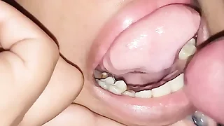 extreme