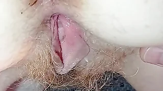 My redhead blanched skin