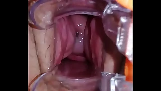 Gozando com o espéculo arreganhando a buceta  Cumming with a speculum broadcasting situation her pussy wide open