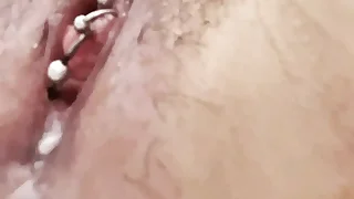Insertion of a stick of give 3 cm come by the urethra