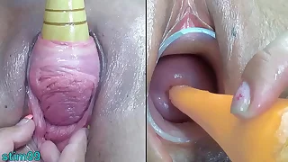 Lesbians Milf Peehole Penetration  Fucking with vegetables